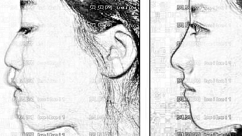 南京恒丽隆鼻多少钱?南京恒丽整形医生介绍+整形价目一览表