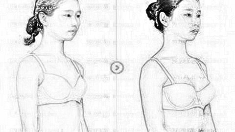 南京施尔美丰胸多少钱?附南京施尔美整形曝光+医生介绍