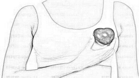 乳晕漂红术多久可以恢复？乳晕漂红术前术后有哪些注意事项