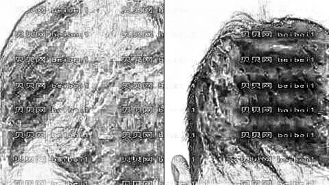南京新生植发医院怎么样?南京新生发际线植发多少钱?附植发介绍