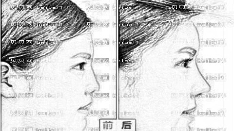 长春赵胜有隆鼻怎么样?赵胜有简介手术风格,内附和介绍