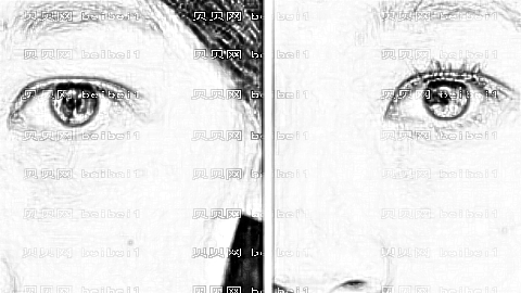 徐州美特莱斯祛眼袋果好吗?附徐州美特莱斯,整形