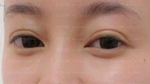 蚌埠东方美莱坞美容医院技术怎么样?,整形价格参考表揭幕!医生介绍