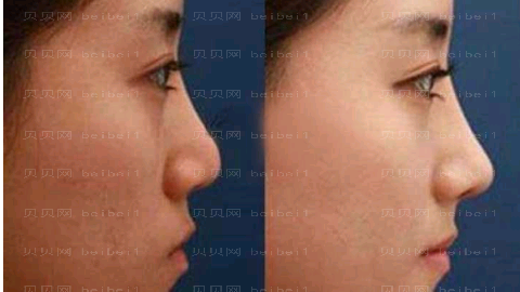 包头叶子美容医院口碑怎么样?,整形价格参考表揭晓!医生介绍