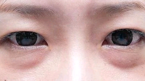 博爱医院做眼睛怎么样?博爱医院做眼睛介绍,医美整形曝光