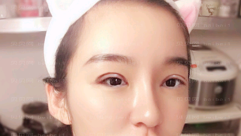 华美张梅做眼睛怎么样?华美张梅做眼睛介绍,整形公布
