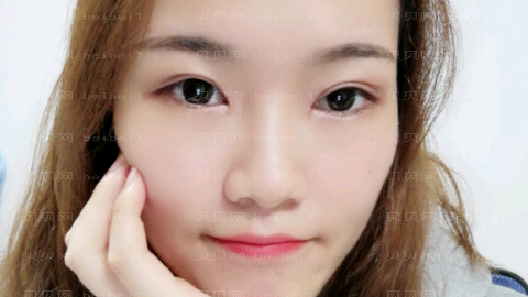 华美紫馨左程做眼睛怎么样?华美紫馨左程做眼睛介绍,整形曝光