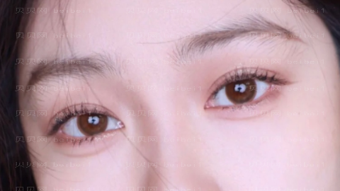 美联臣李燕做眼睛怎么样?美联臣李燕做眼睛介绍及