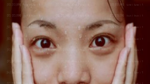 华韩谢立宁做眼睛怎么样?华韩谢立宁做眼睛介绍,眼睛变大了!