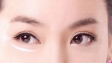 武汉恩吉娜的段院长做眼睛怎么样?武汉恩吉娜的段院长做眼睛介绍及
