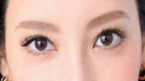 重医附一院做双眼皮好吗?介绍及,项目收费表