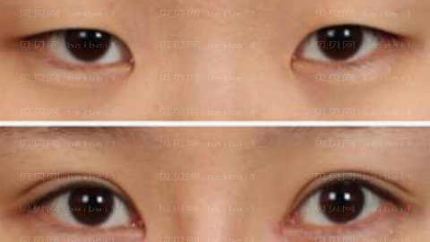 洛阳莱尔美做眼睛怎么样?洛阳莱尔美做眼睛介绍及