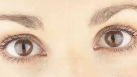 沈阳刘哲丽做眼睛玻切手术怎么样?沈阳刘哲丽做眼睛介绍及