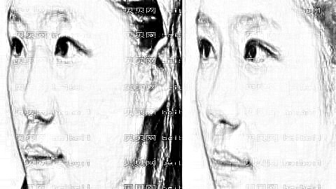 石家庄张晓建隆鼻好不好？张晓建假体隆鼻+介绍,神来之鼻！