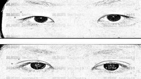 石家庄双眼皮修复专家测评|附介绍分享+石家庄眼修复一览