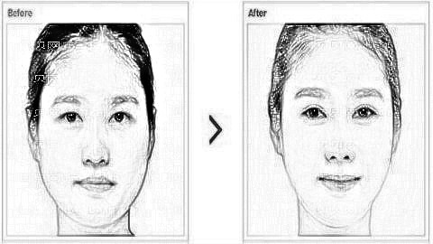 西安爱特蜜整形医院口碑怎么样?双眼皮靠谱吗?内附整形