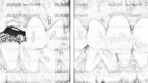 南京美奥口腔全口种植牙多少钱？哪个医生种植牙技术好？附