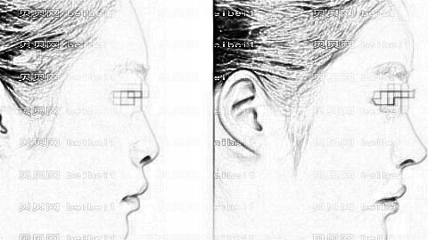 益阳格莱美隆鼻怎么样?益阳格莱美整形曝光+医生介绍