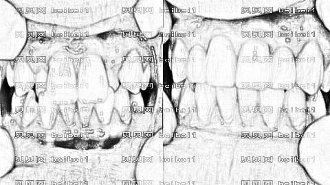 长沙中诺口腔医院靠谱吗?长沙中诺口腔种植牙多少钱?附介绍