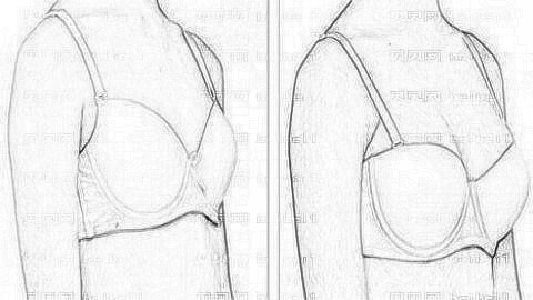 葛艳娜乳房下垂矫正做得怎么样?葛艳娜隆胸+介绍分享