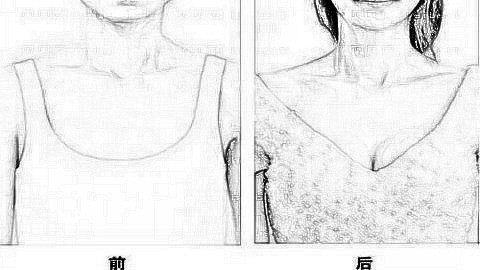 乌鲁木齐华美整形医院正规吗?哪些医生靠谱?内附,版
