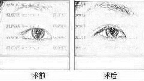 武汉美都整形医院怎么样?武汉美都双眼皮医生名单,内附