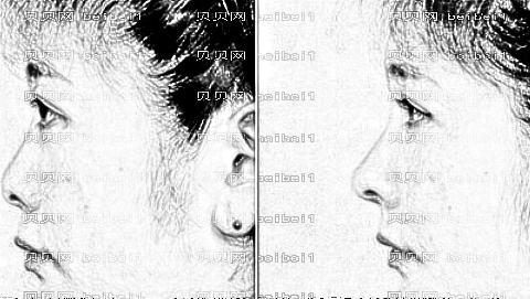 福州比华利整形医院怎么样？医生团队+整形价格