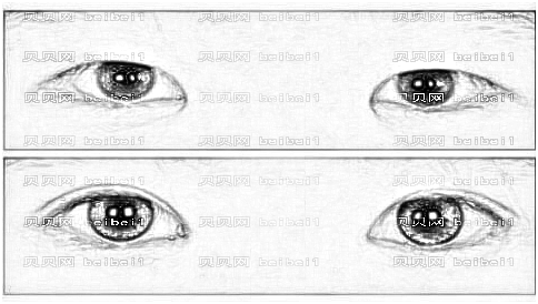 美之峰解灿双眼皮做的怎么样?内附医生评价+双眼皮价格一览表