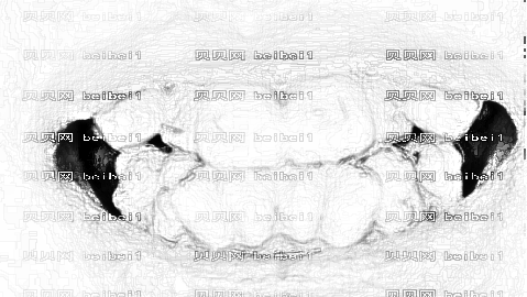 交大二附院牙齿矫正果好吗?牙齿矫正介绍+,整形曝光