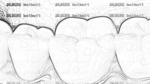 交大二附院牙齿矫正果好吗?牙齿矫正介绍+,整形曝光