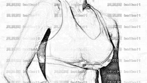 苏州一院丰胸怎么样?胸部整形介绍及,?