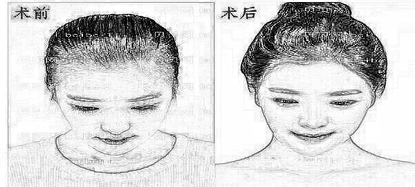 南京植发医院选择哪家?南京植发医院哪家技术好?收费价格高吗?