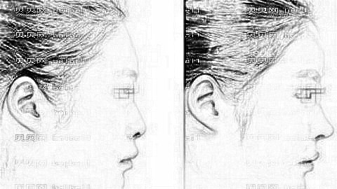 郑州东方吴振医生做鼻子怎么样?附吴振隆鼻风格介绍+介绍分享