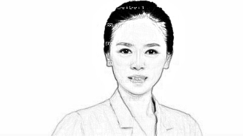 郑大二附院刘月丽做眼睛靠谱吗?刘月丽割双眼皮多少钱?附介绍