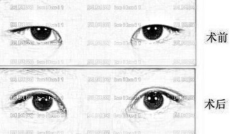 阜阳做双眼皮哪家医院好？阜阳双眼皮医生排名名单&附介绍