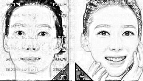 滁州祛斑哪家医院好?滁州激光祛斑多少钱?附祛斑介绍