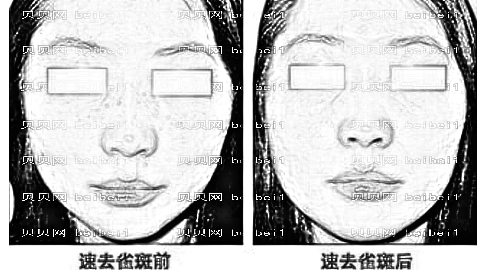 德州祛斑哪家医院好?德州激光祛斑多少钱?附祛斑介绍