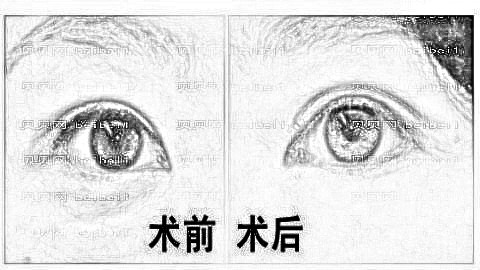 东营去眼袋哪家医院好?东营去眼袋医生排名名单&附介绍