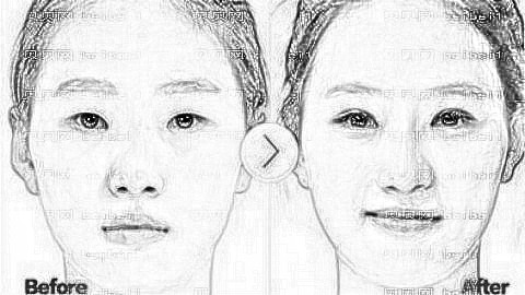 乐凤亮医生怎么样?乐凤亮做双眼皮价格贵吗?附乐凤亮双眼皮介绍