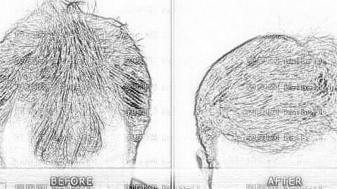 重庆迪邦医院植发怎么样?靠谱吗?迪邦植发收费高吗?附介绍