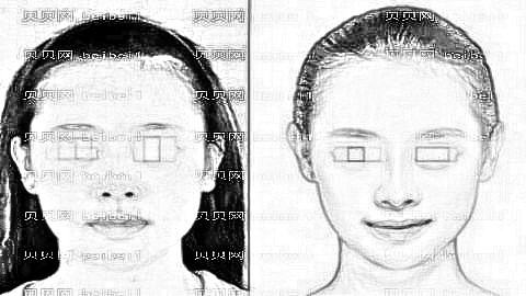 重庆植发医院排名前五榜单|附重庆植发&发际线植发介绍