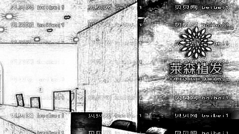 重庆莱森植发医院正规吗?莱森植发一般多少钱?附种植介绍分享