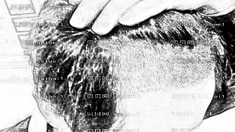 重庆莱森植发医院正规吗?莱森植发一般多少钱?附种植介绍分享