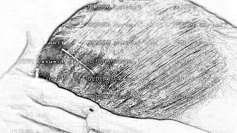 重庆有哪些正规的植发医院?重庆欧亚植发医院怎么样?正规吗?
