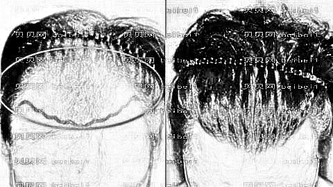 成都正规的植发医院介绍|成都新生植发、成都雍禾植发均上榜