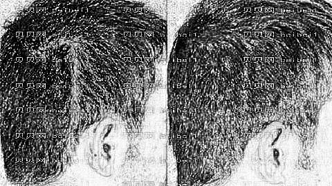 成都首瑞毛发移植医院怎么样？成都首瑞植发多少钱？哪个医生好