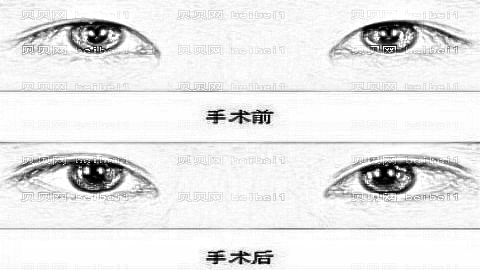 深圳瑞芙臣整形医院怎么样?内部整形曝光!医生介绍