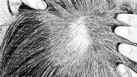 北京植发哪家医院好?多少钱?附北京植发医生排名名单