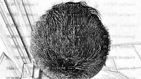 杭州正规植发医院哪家好?杭州植发多少钱?附杭州植发医生排名