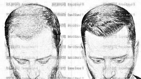 合肥植发哪家医院好?多少钱?附合肥植发医生排名名单